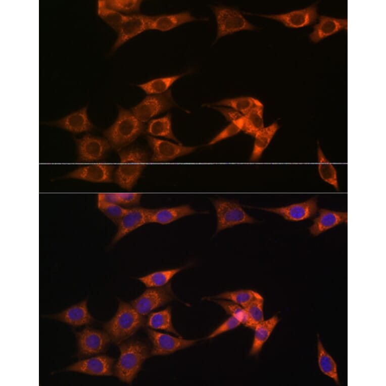 Immunofluorescence - Anti-ASB3 Antibody (A329130) - Antibodies.com