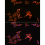 Immunofluorescence - Anti-ASB3 Antibody (A329130) - Antibodies.com