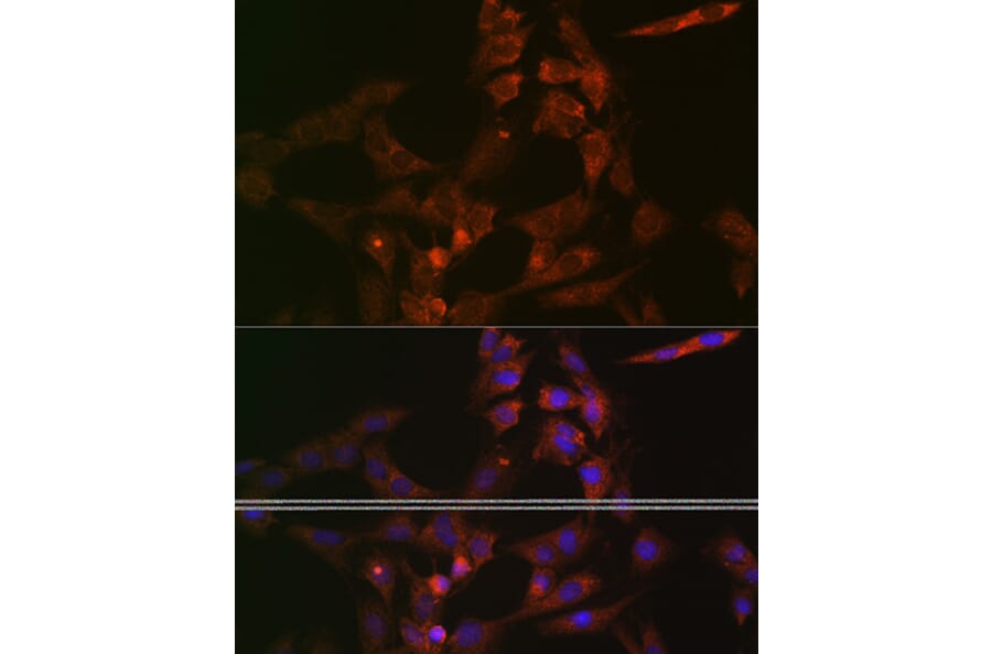 Immunofluorescence - Anti-ASB3 Antibody (A329130) - Antibodies.com