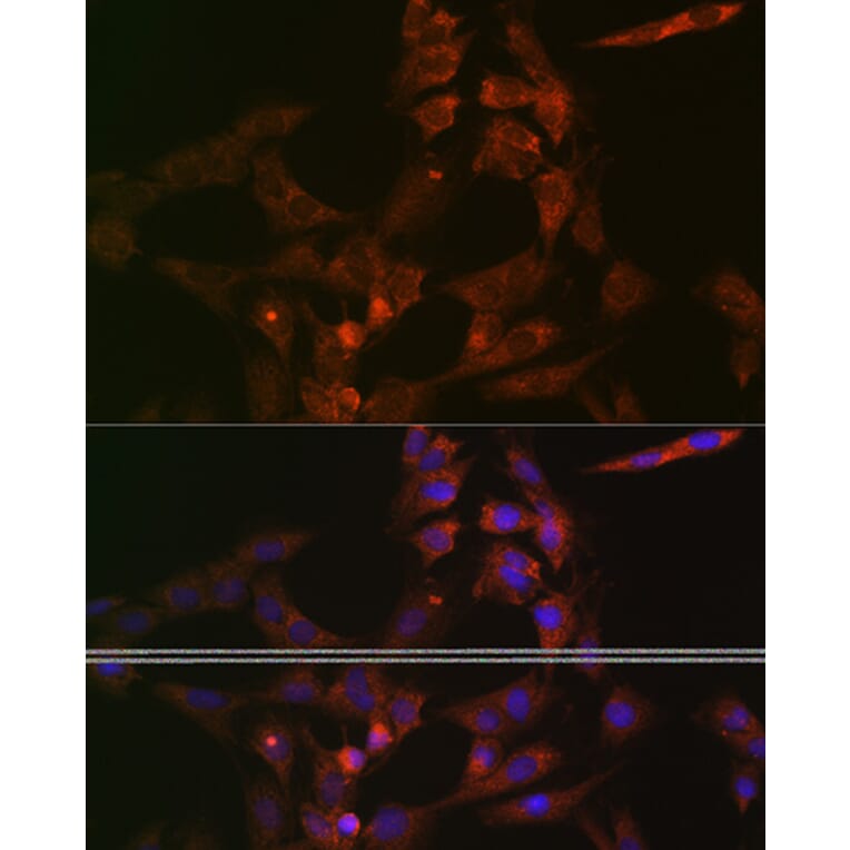 Immunofluorescence - Anti-ASB3 Antibody (A329130) - Antibodies.com