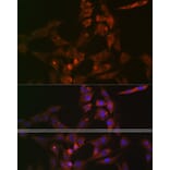 Immunofluorescence - Anti-ASB3 Antibody (A329130) - Antibodies.com