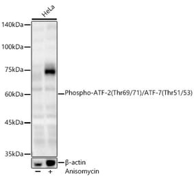 Western Blot - Anti-ATF2 (Phospho T69/71 & Phospho T51/53) Antibody (A329131) - Antibodies.com