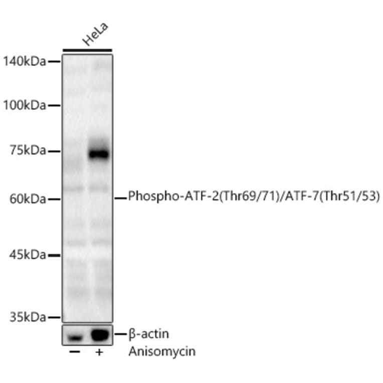 Western Blot - Anti-ATF2 (Phospho T69/71 & Phospho T51/53) Antibody (A329131) - Antibodies.com