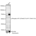 Western Blot - Anti-ATF2 (Phospho T69/71 & Phospho T51/53) Antibody (A329131) - Antibodies.com