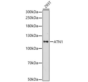 Western Blot - Anti-ATN1 Antibody (A329133) - Antibodies.com