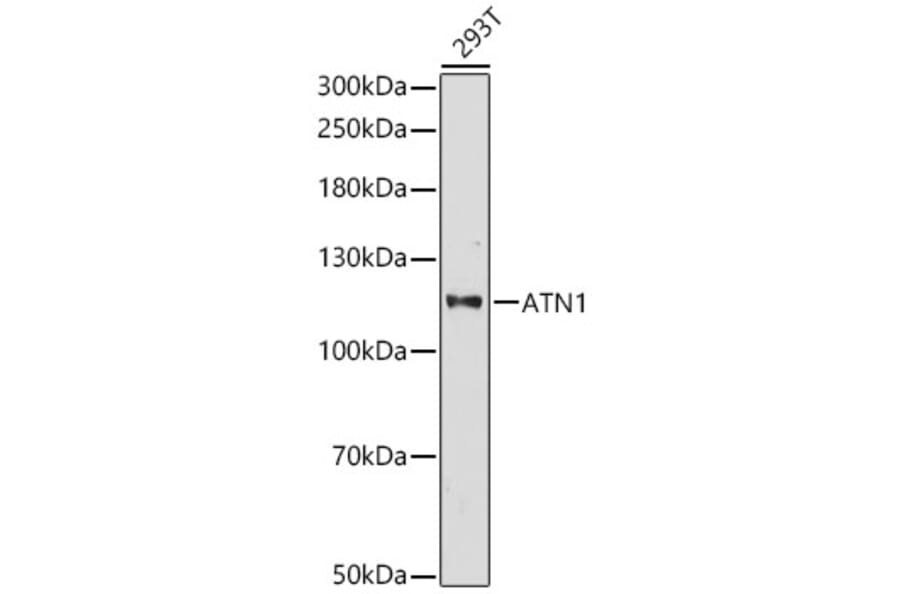 Western Blot - Anti-ATN1 Antibody (A329133) - Antibodies.com