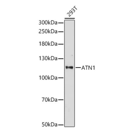 Western Blot - Anti-ATN1 Antibody (A329133) - Antibodies.com