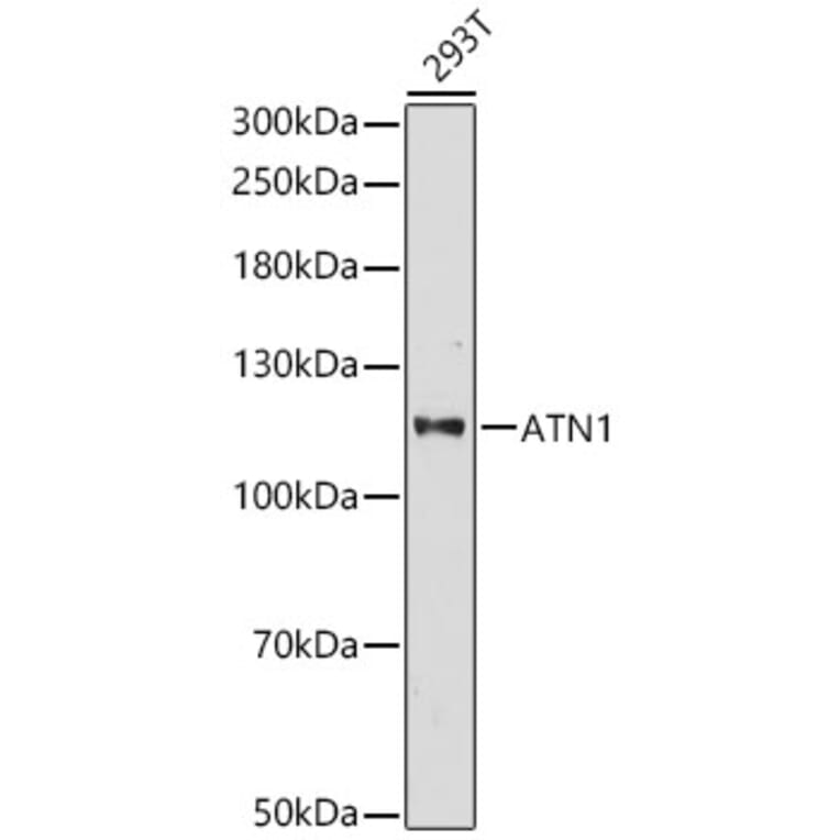 Western Blot - Anti-ATN1 Antibody (A329133) - Antibodies.com