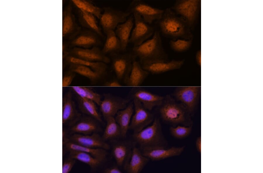Immunofluorescence - Anti-ATN1 Antibody (A329133) - Antibodies.com