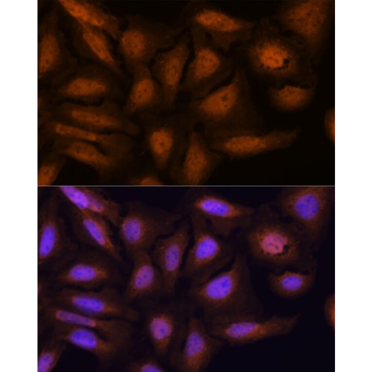 Immunofluorescence - Anti-ATN1 Antibody (A329133) - Antibodies.com