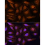 Immunofluorescence - Anti-ATN1 Antibody (A329133) - Antibodies.com