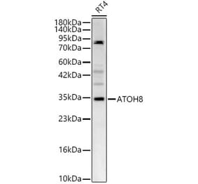 Western Blot - Anti-ATOH8 Antibody (A329134) - Antibodies.com