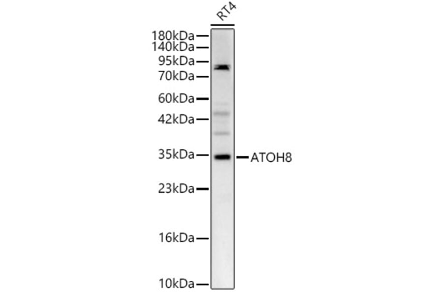 Western Blot - Anti-ATOH8 Antibody (A329134) - Antibodies.com