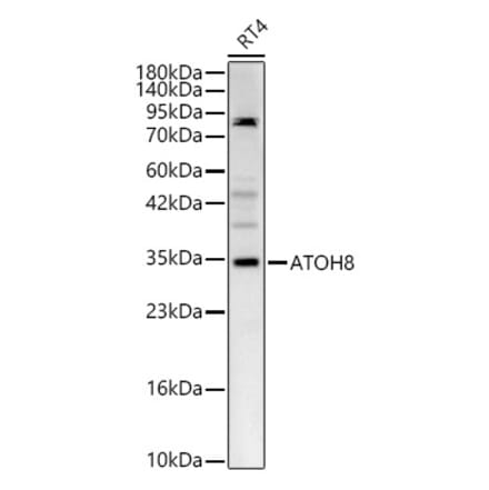 Western Blot - Anti-ATOH8 Antibody (A329134) - Antibodies.com