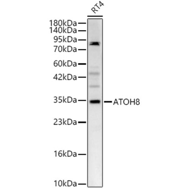 Western Blot - Anti-ATOH8 Antibody (A329134) - Antibodies.com