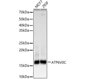 Western Blot - Anti-ATP6V0C Antibody [ARC61235] (A329135) - Antibodies.com