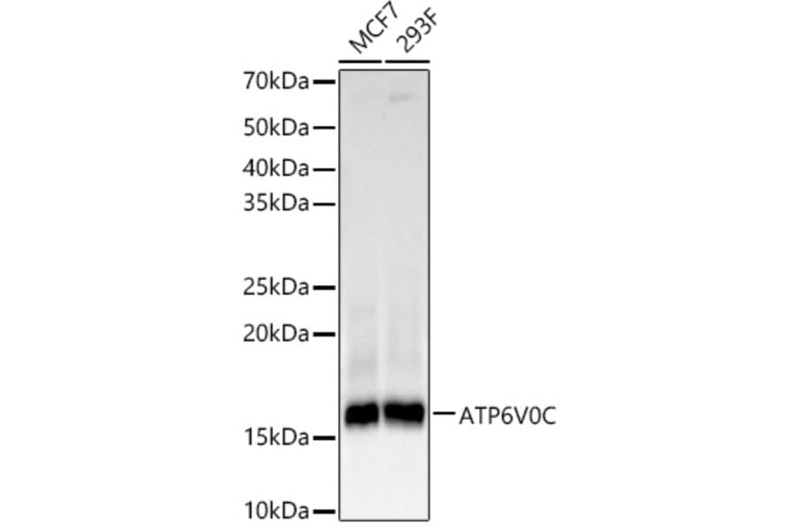 Western Blot - Anti-ATP6V0C Antibody [ARC61235] (A329135) - Antibodies.com