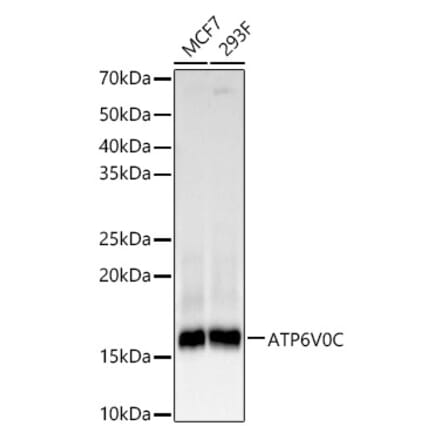 Western Blot - Anti-ATP6V0C Antibody [ARC61235] (A329135) - Antibodies.com