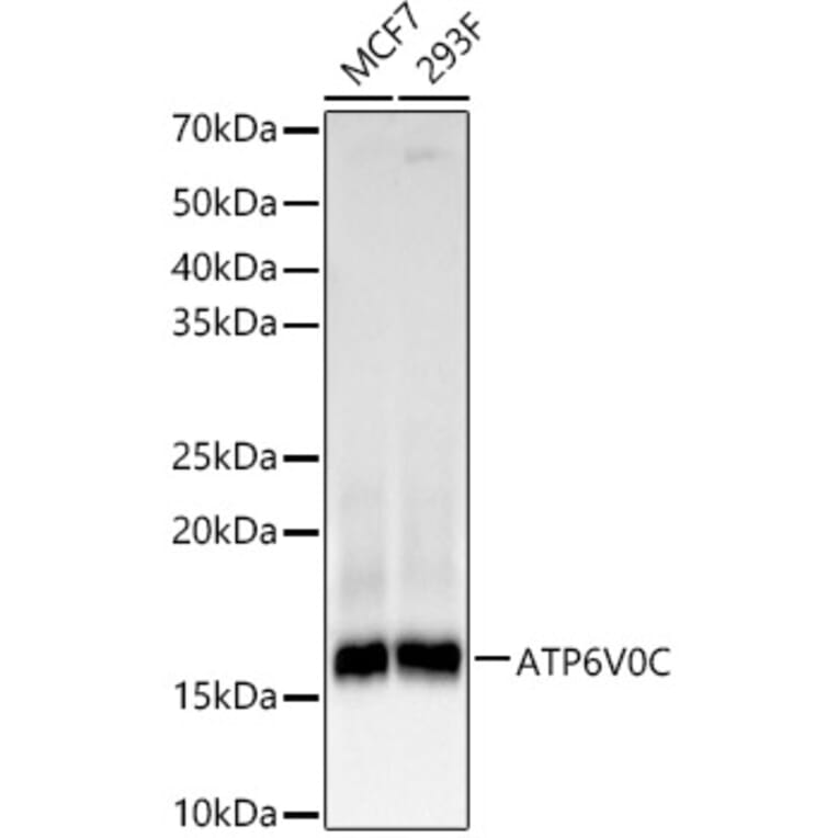 Western Blot - Anti-ATP6V0C Antibody [ARC61235] (A329135) - Antibodies.com