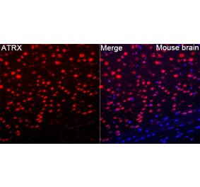 Immunofluorescence - Anti-ATRX Antibody (A329136) - Antibodies.com