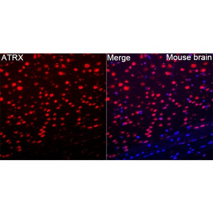 Immunofluorescence - Anti-ATRX Antibody (A329136) - Antibodies.com