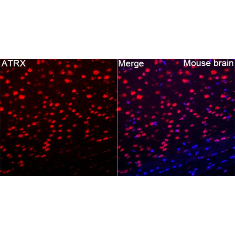 Immunofluorescence - Anti-ATRX Antibody (A329136) - Antibodies.com