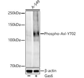 Western Blot - Anti-Axl (Phospho Y702) Antibody [ARC58385] (A329138) - Antibodies.com