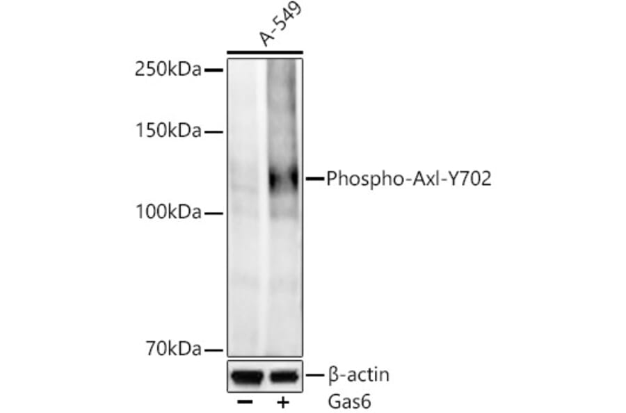 Western Blot - Anti-Axl (Phospho Y702) Antibody [ARC58385] (A329138) - Antibodies.com