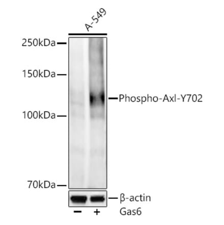 Western Blot - Anti-Axl (Phospho Y702) Antibody [ARC58385] (A329138) - Antibodies.com