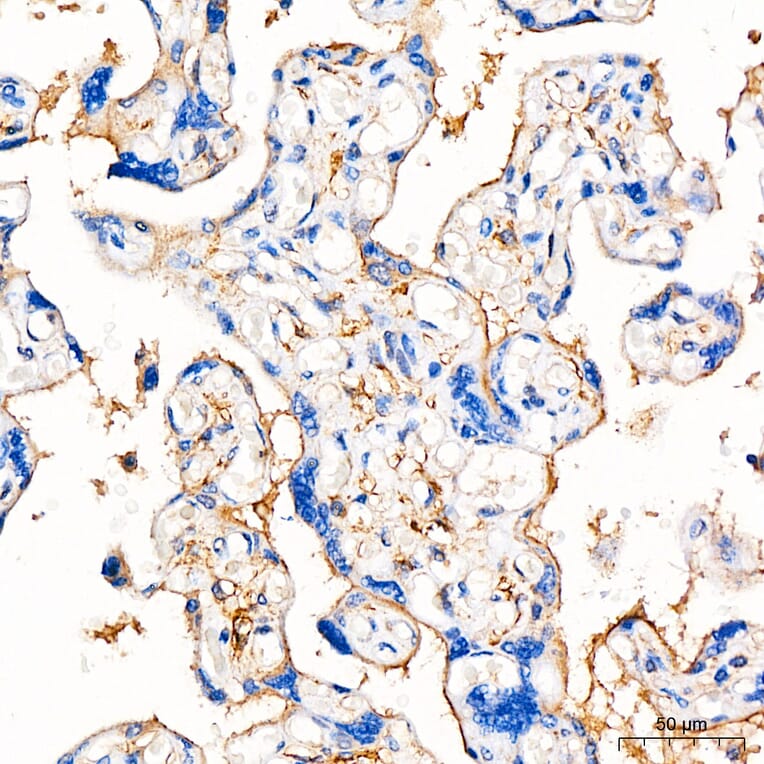 Immunohistochemistry - Anti-B7-H3 Antibody (A329142) - Antibodies.com