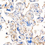 Immunohistochemistry - Anti-B7-H3 Antibody (A329142) - Antibodies.com