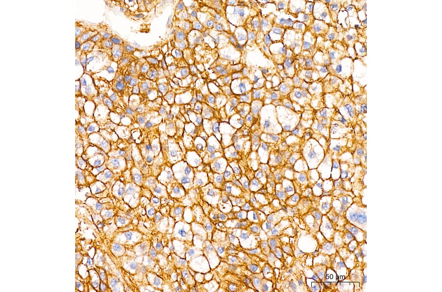 Immunohistochemistry - Anti-B7-H3 Antibody (A329142) - Antibodies.com