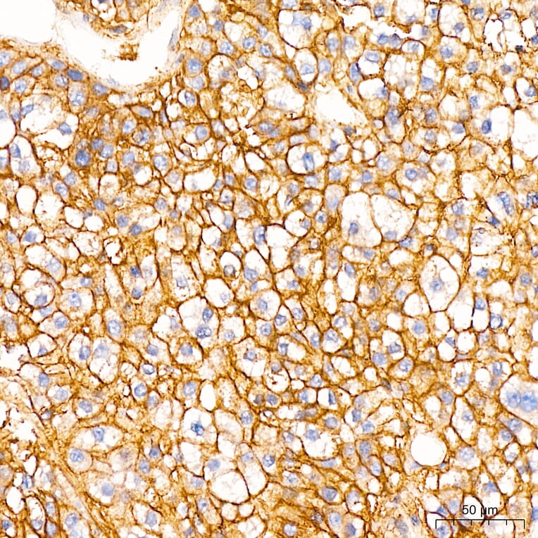 Immunohistochemistry - Anti-B7-H3 Antibody (A329142) - Antibodies.com