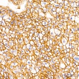 Immunohistochemistry - Anti-B7-H3 Antibody (A329142) - Antibodies.com