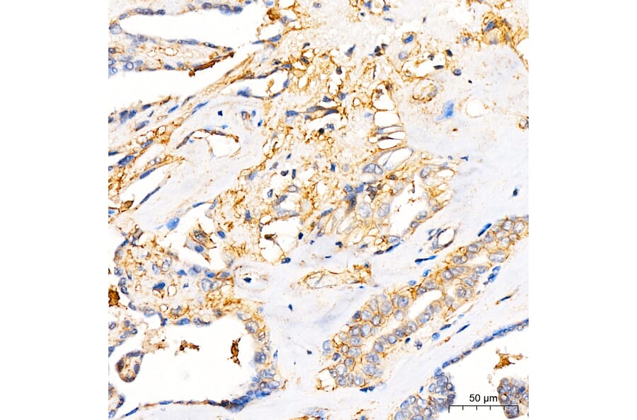 Immunohistochemistry - Anti-B7-H3 Antibody (A329142) - Antibodies.com
