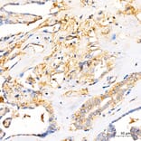 Immunohistochemistry - Anti-B7-H3 Antibody (A329142) - Antibodies.com