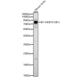 Western Blot - Anti-B7-H4 Antibody (A329143) - Antibodies.com