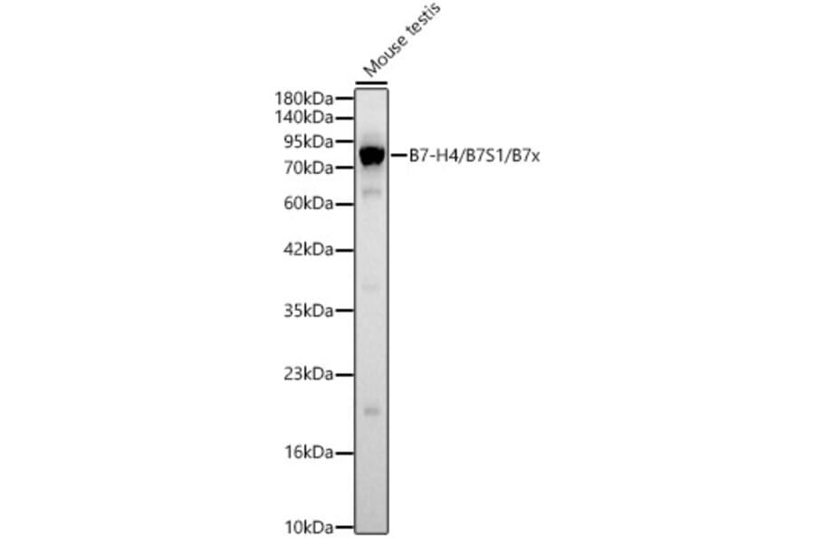 Western Blot - Anti-B7-H4 Antibody (A329143) - Antibodies.com