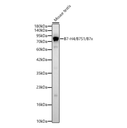 Western Blot - Anti-B7-H4 Antibody (A329143) - Antibodies.com
