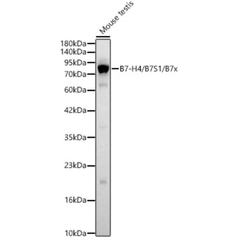 Western Blot - Anti-B7-H4 Antibody (A329143) - Antibodies.com