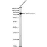Western Blot - Anti-B7-H4 Antibody (A329143) - Antibodies.com