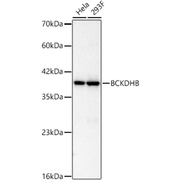 Western Blot - Anti-BCKDHB Antibody [ARC62321] (A329146) - Antibodies.com