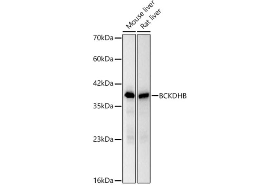 Western Blot - Anti-BCKDHB Antibody [ARC62321] (A329146) - Antibodies.com