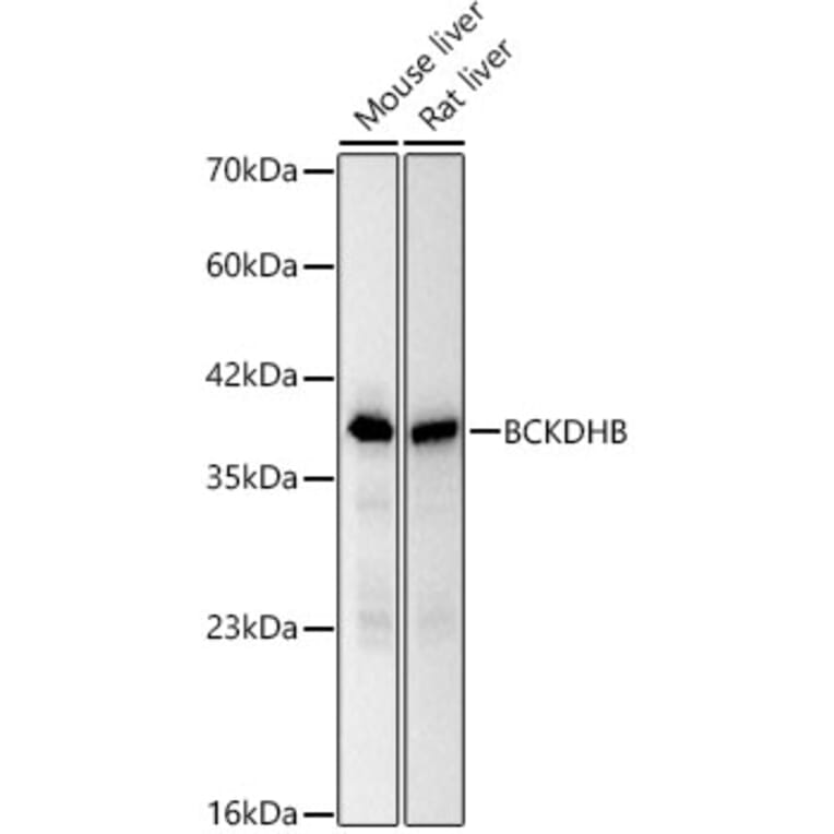 Western Blot - Anti-BCKDHB Antibody [ARC62321] (A329146) - Antibodies.com