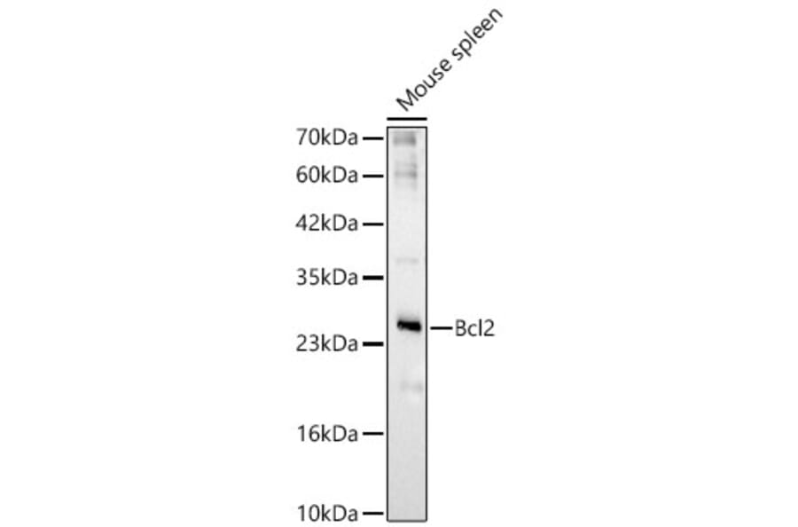 Western Blot - Anti-Bcl-2 Antibody (A329147) - Antibodies.com