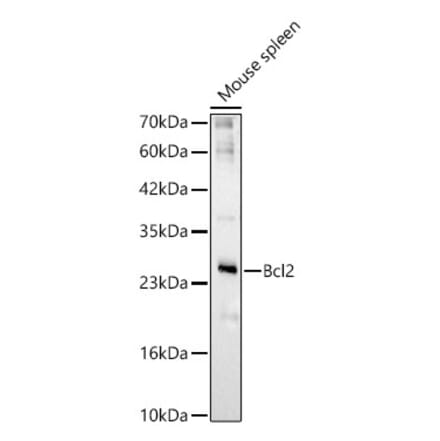 Western Blot - Anti-Bcl-2 Antibody (A329147) - Antibodies.com