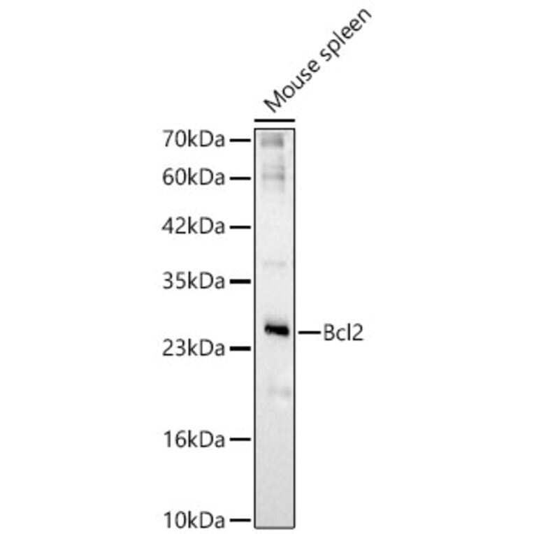 Western Blot - Anti-Bcl-2 Antibody (A329147) - Antibodies.com