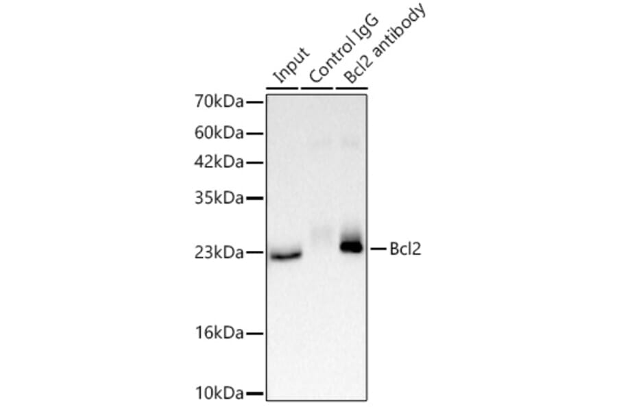 Western Blot - Anti-Bcl-2 Antibody (A329147) - Antibodies.com
