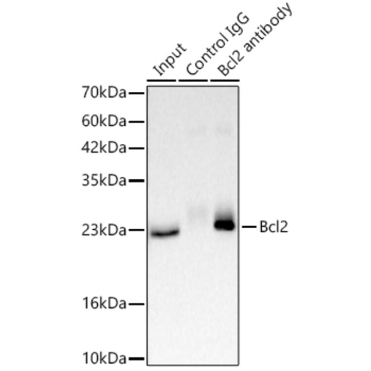 Western Blot - Anti-Bcl-2 Antibody (A329147) - Antibodies.com