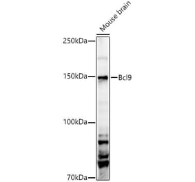 Western Blot - Anti-BCL9 Antibody (A329149) - Antibodies.com